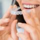 Clear Aligners A Great Choice For Shifting Teeth-min